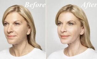 Antes y después de usar la Goji Cream