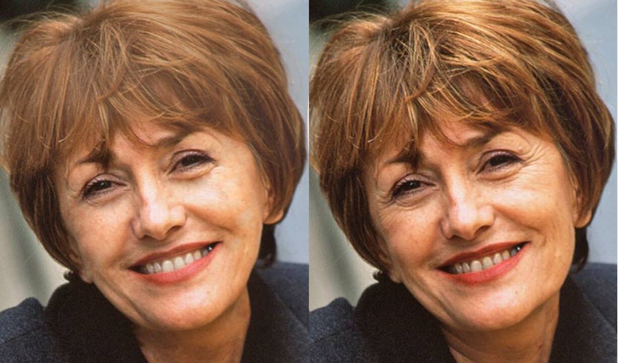 Fotos faciales antes y después del contorno. 